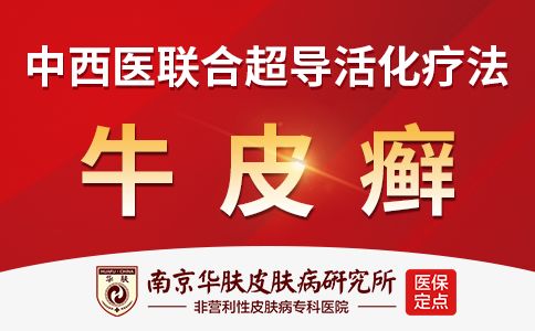 南京银屑病医院选“南京华肤”南京银屑病中西医结合治疗医院