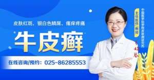 南京治疗牛皮癣医院-全新榜单-牛皮癣怎么治疗？