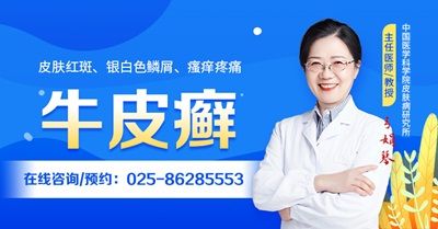 热门排行：南京治疗牛皮癣医院哪家好前三名-南京治疗牛皮癣的费用