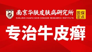 今日公布!治疗牛皮癣医院南京哪里好排行总榜实时公开