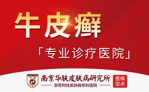 牛皮癣的早期症状有哪些？南京治疗牛皮癣好的医院
