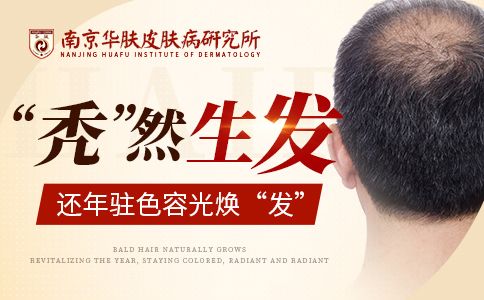 脂溢性脱发怎么治疗“南京脱发去医院挂哪个科”