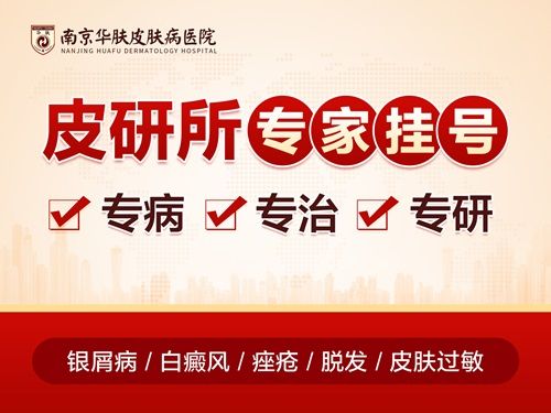 今日推荐：南京治银屑病哪个医院好“综合评比”南京华肤银屑病治疗医院